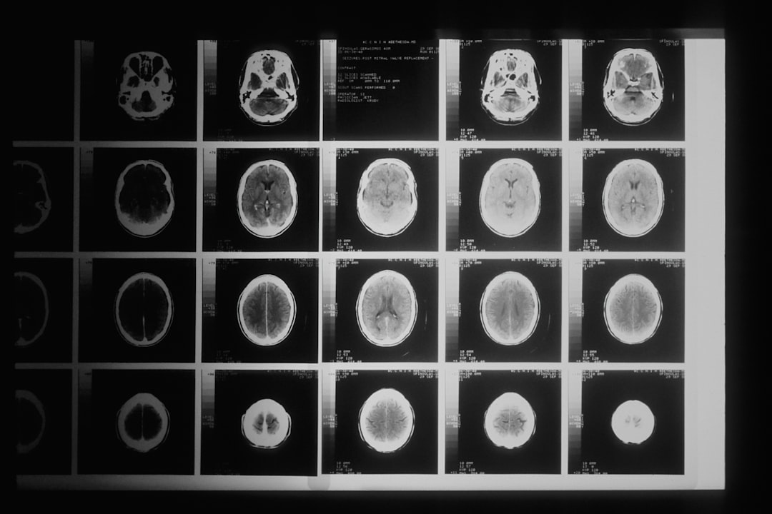 Mózg na czerwonym alarmię. Dlaczego polska neurologia wciąż czeka na swój wielki przełom?