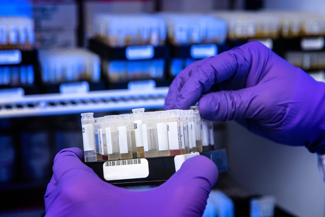 Przełom w diagnostyce onkologicznej. Domowy test moczu wykrywa raka pęcherza z dużą precyzją